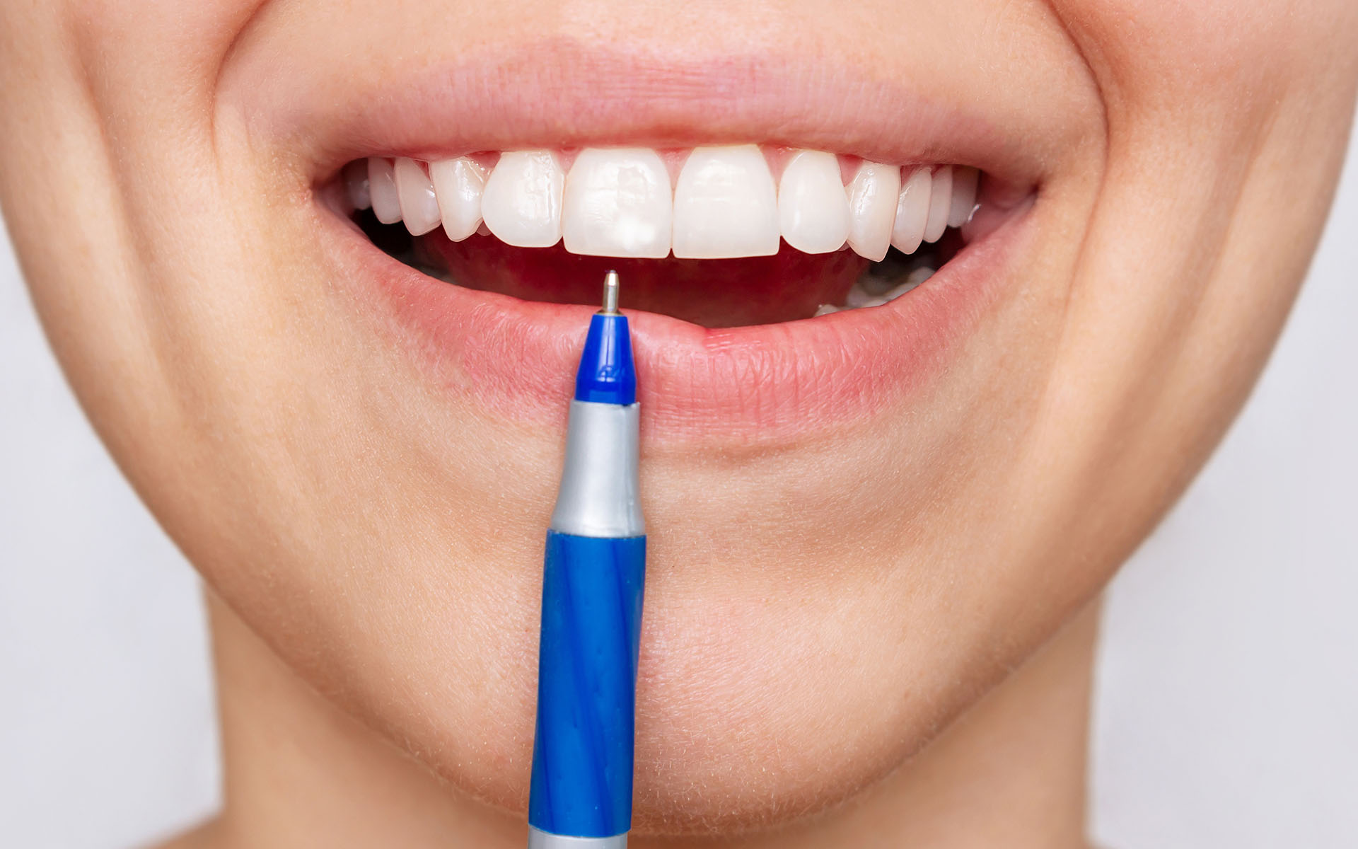 Why Does the Tooth Become Transparent?