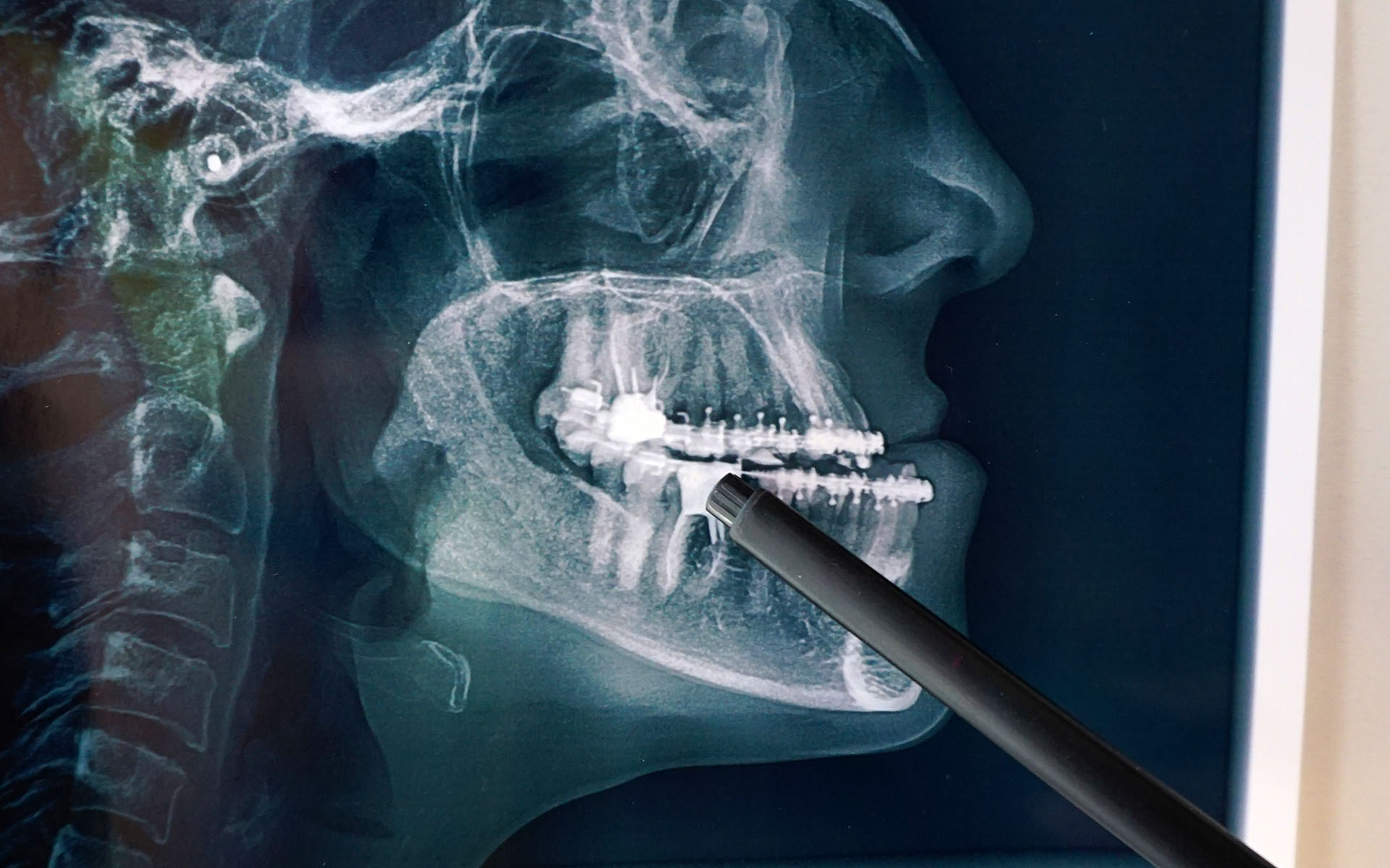 Maxillofacial Surgery