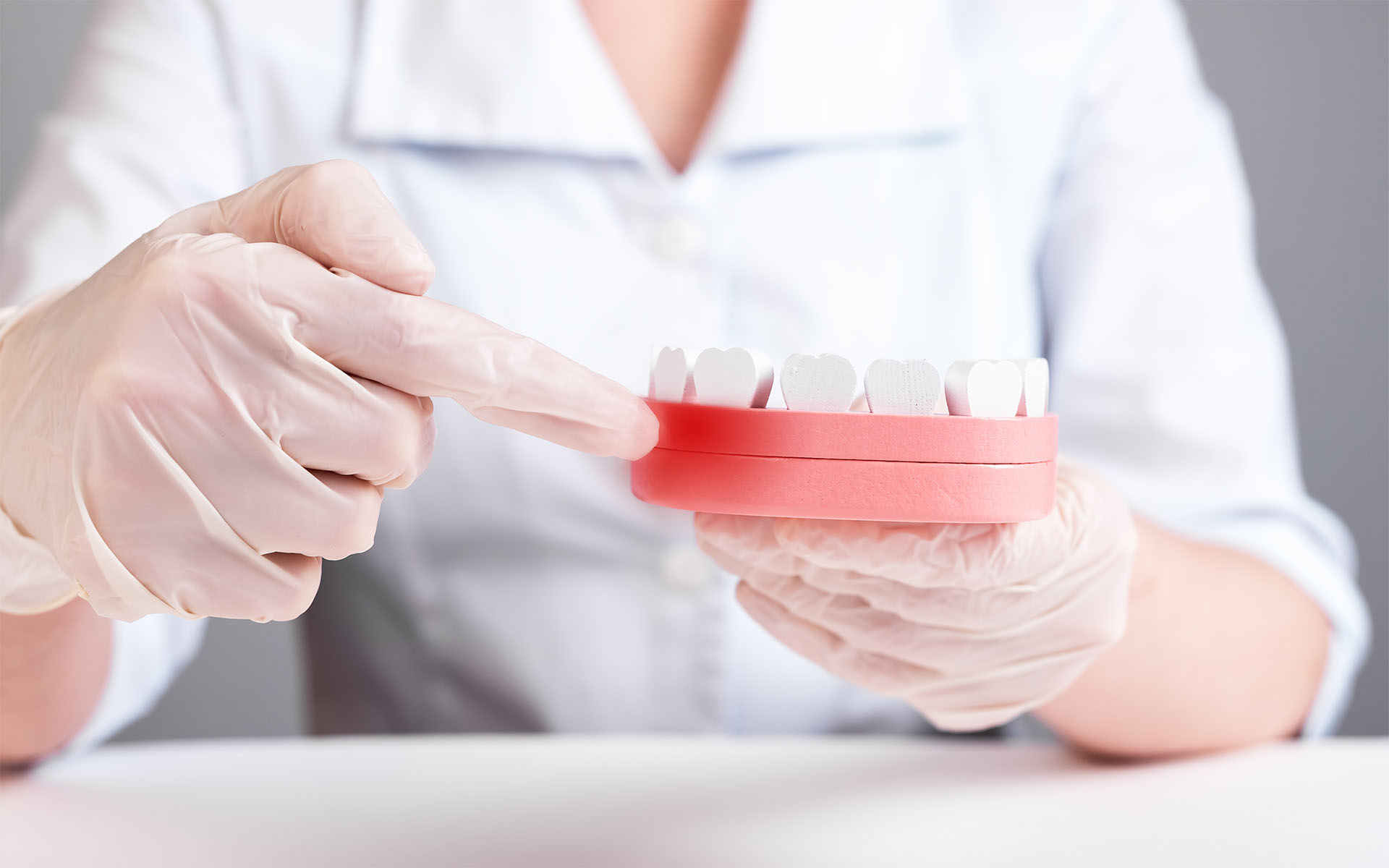 Gingival (Periodontal) Diseases