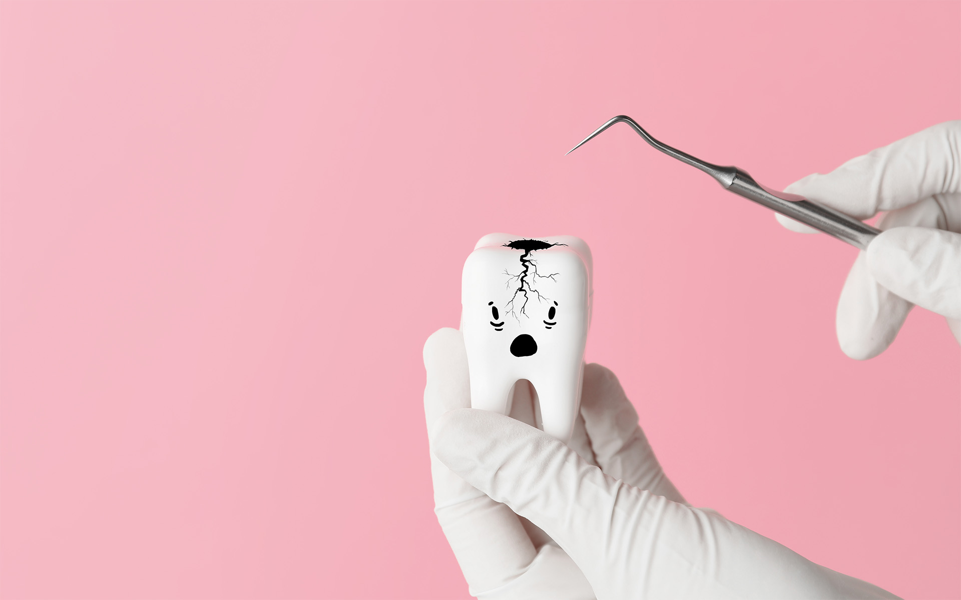 What is a Dental Cavity?