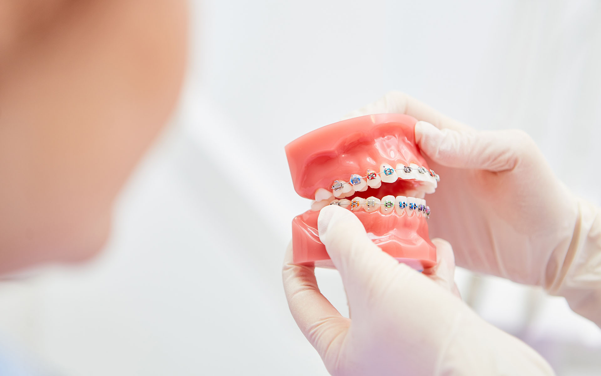 What is Malocclusion (Tooth Occlusion Disorder)?